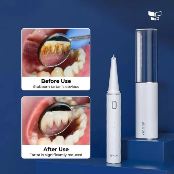 XIAOMI SUNUO T12 Pro Ultrasonic Dental Oral Teeth Cleaner Removal Whitening